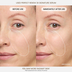 Perfect Renew 3X Signature Serum
